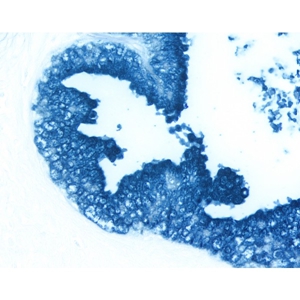 Preparation of BCIP/NBT Color Development Solution