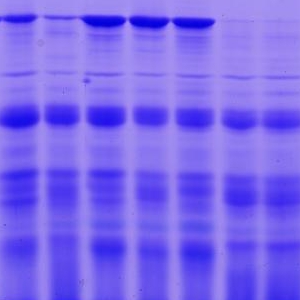 Preparation of Tricine-SDS-PAGE Gel